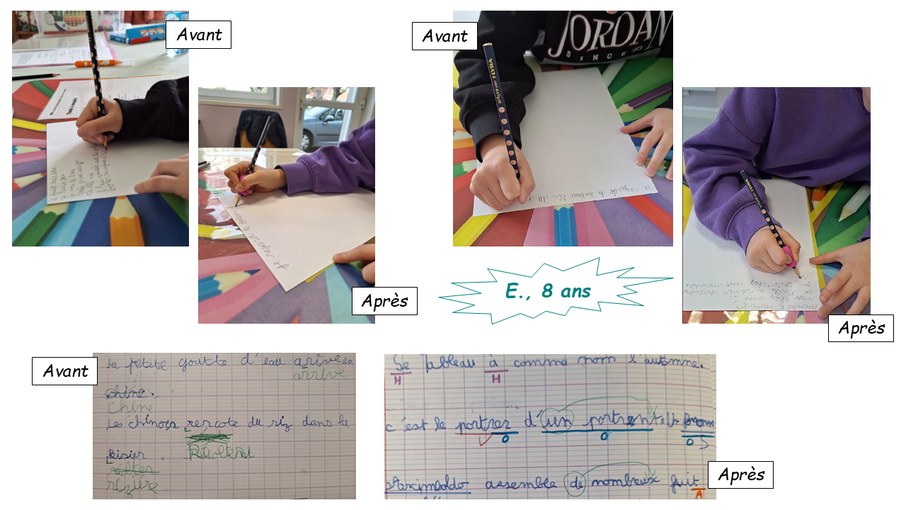 Comparaison Avant / Après